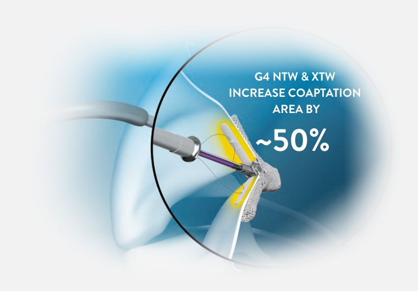 G4 NTW & XTW increase coaption area by ~50%