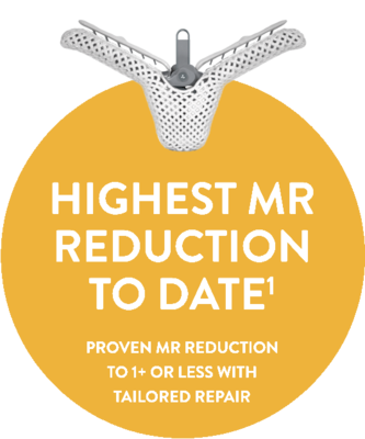 MitraClip™ - Proven MR reduction to 1+ or less with tailored repair